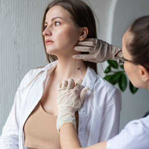 consulta dermatología